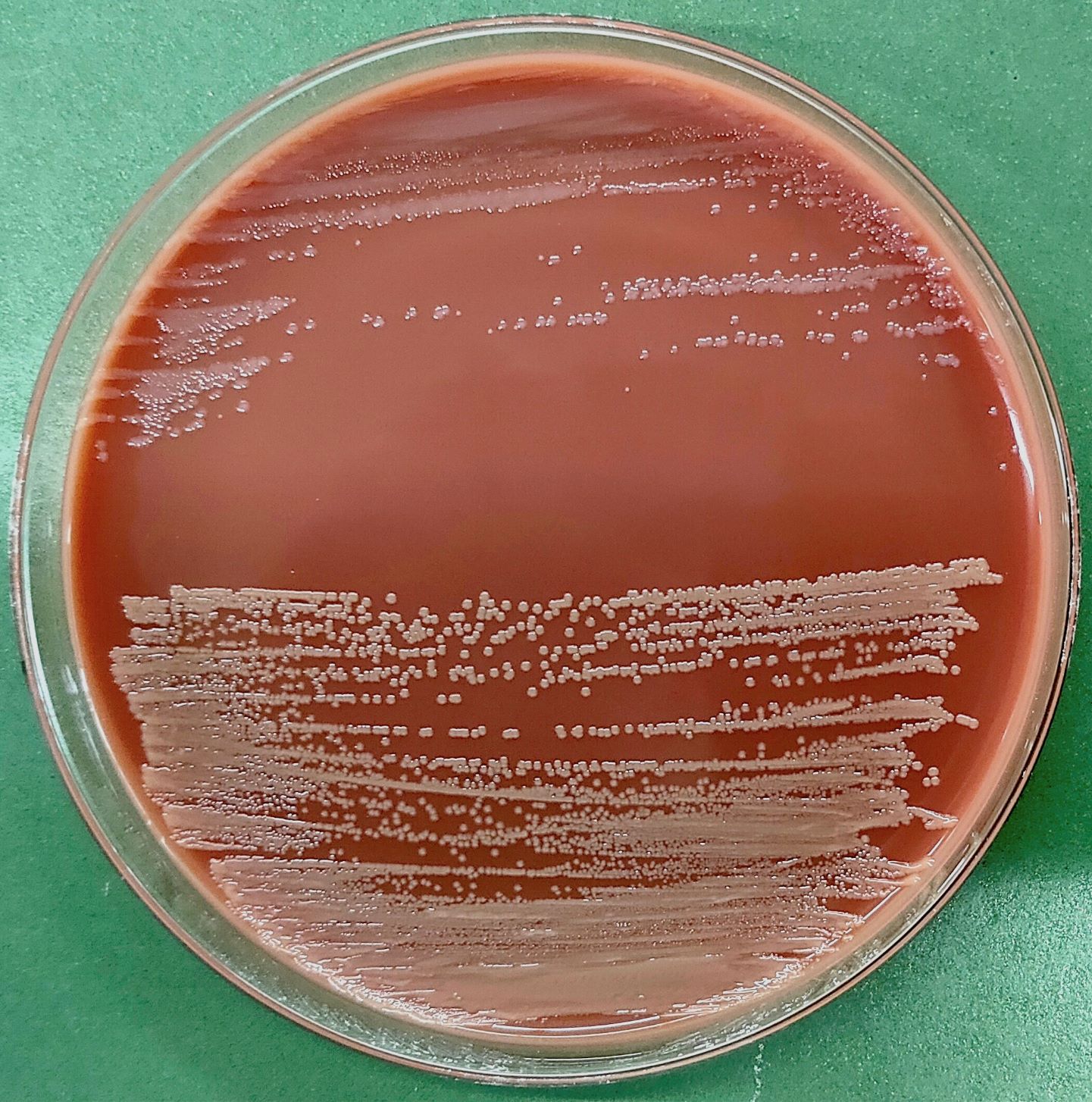 Neisseria Gonorrhoeae Plate